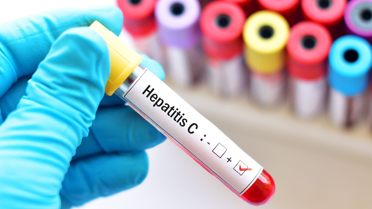 Hepatitis C una enfermedad 