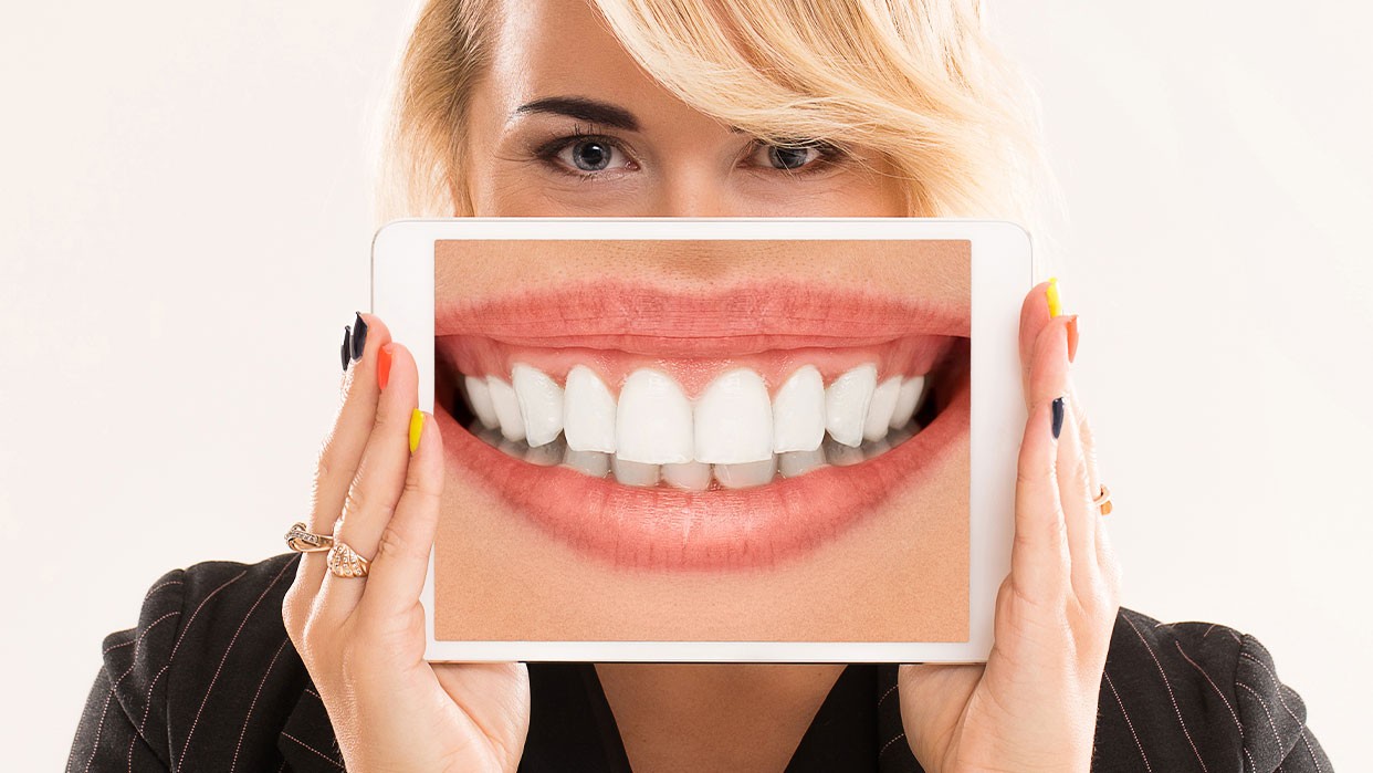 Tener dientes blancos es uno de los ideales de belleza con mayor inversión